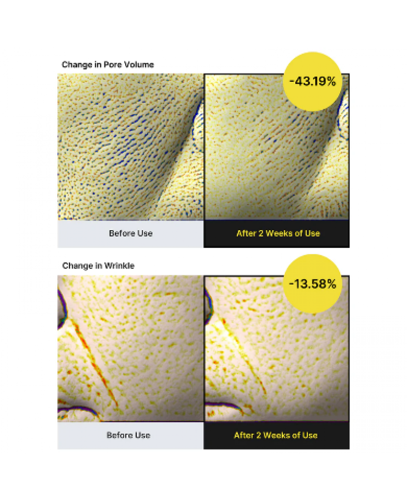 Сыворотка подтягивающая с ретинолом и микроиглами 